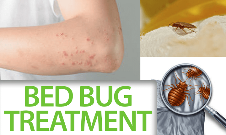 treatment for bed bugs on mattress